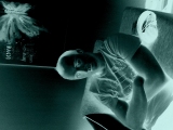 Samer